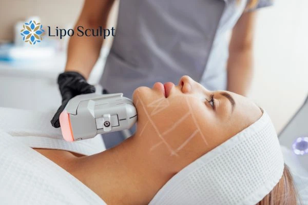 HIFU vs Botulinum Toxin: Understanding the Differences 1 HIFU vs Botox Melton Mowbray What is the best option for you?