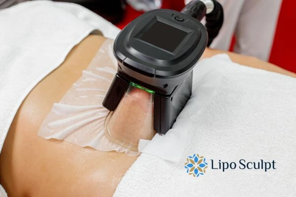 Does Fat Freezing at Home Work? DIY Devices vs Professional Cryolipolysis 1 How is professional cryolipolysis different Melton Mowbray?
