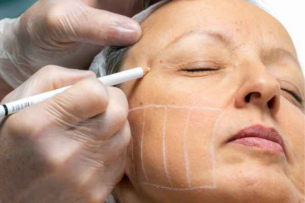 CryoPen: 5 Skin Concerns It May Be Used to Treat 4 What should you ask before having CryoPen treatment Melton Mowbray?